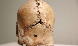 Aksaray’da dünyanın ilk beyin ameliyatının yapıldığı Aşıklı Höyük