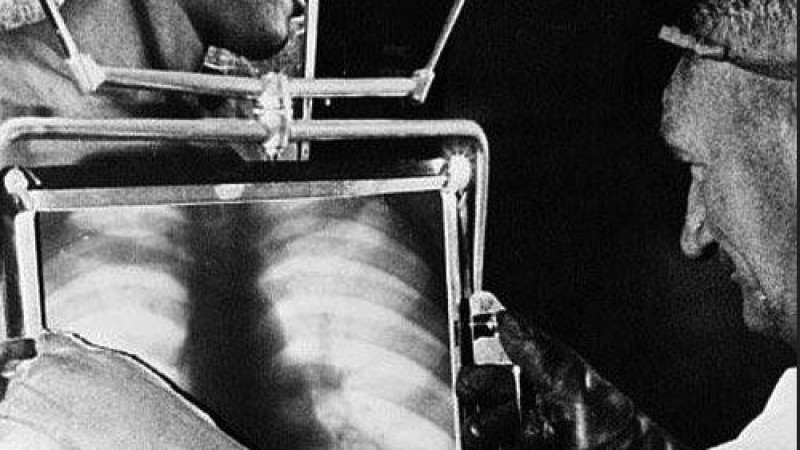 Bedeni Aranan İşçiler: Sömürünün Radyasyonlu Tarihi