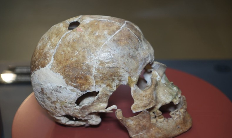 Antik Tıbbın Merkezi Samsun: 5 Bin Yıllık Ameliyatlı Kafatasını Gördünüz mü?